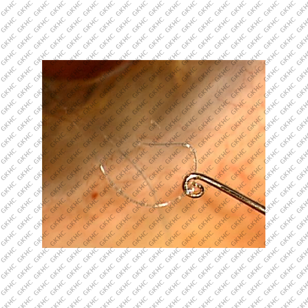 Devgan Intraocular Suturing Hook (GKHC-26224)